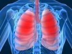COPD